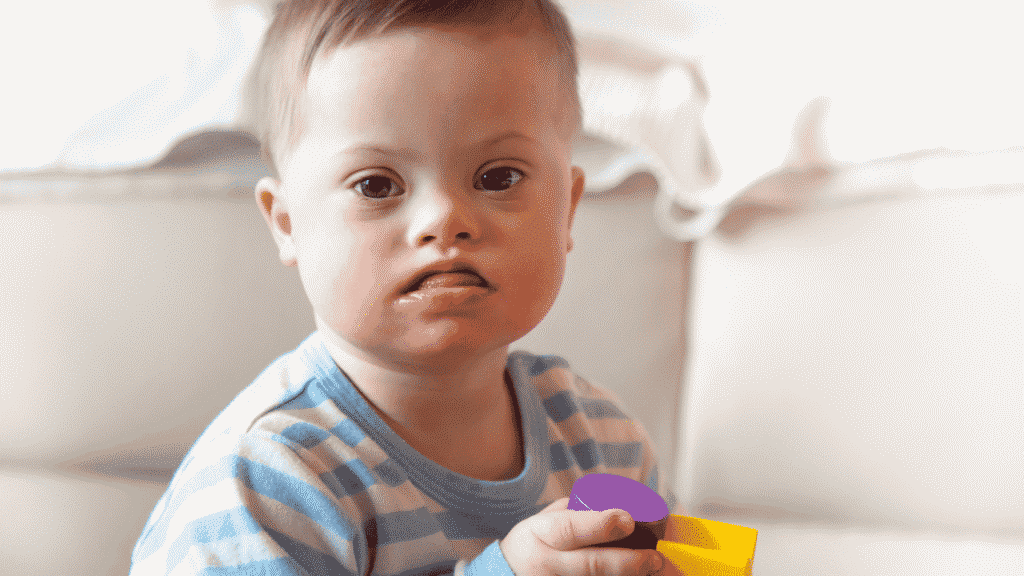 Understanding Down Syndrome child