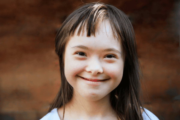 understanding down syndrome