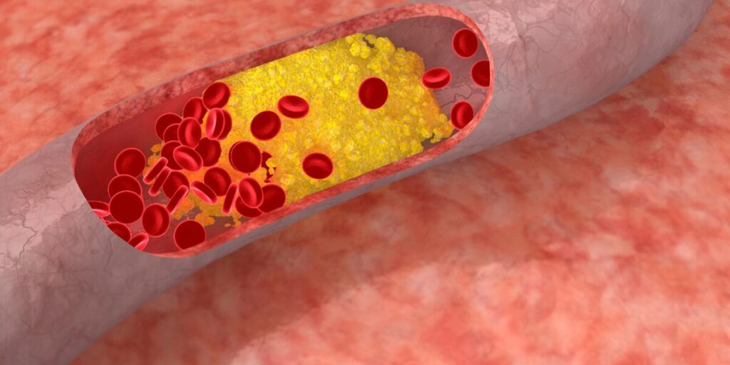  a cholesterol block the cell