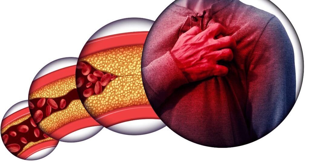 a person block heart due to discontinue flow of blood