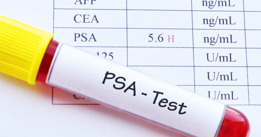 PSA Testing(Prostate-Specific Antigen )