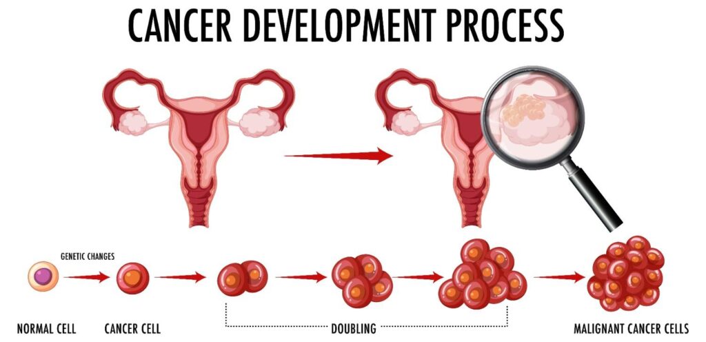 cervical cancer development process